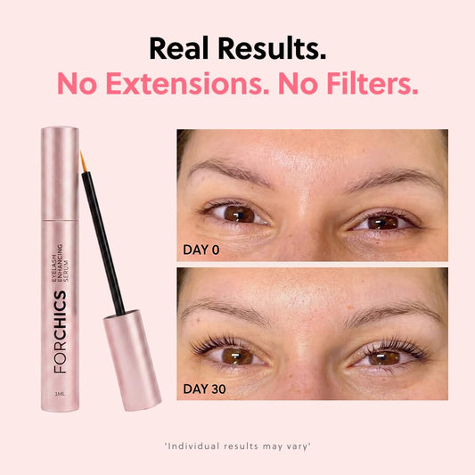 ForChics Eyelash Growth Serum - Prostaglandin-Free Lash Enhancing Serum for Longer, Thicker Lashes and Brows- Natural Formula, Visible Results in 2 Weeks - Vegan, Hormone-Free 0.10 fl. oz / 3ml